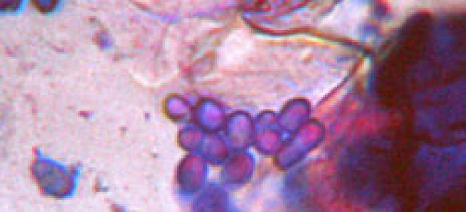 Малацезия у кошек лечение в домашних условиях